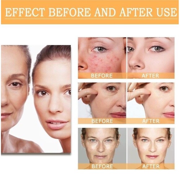 Glycolic Acid 7% Toning Resurfacing Solution PH 3.6 100ml 3.38 Oz New Sealed - Picture 5 of 6